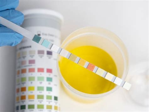 urine test hard|normal urine temperature test.